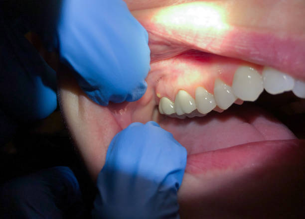 Best Emergency TMJ Treatment in Waynesboro, TN