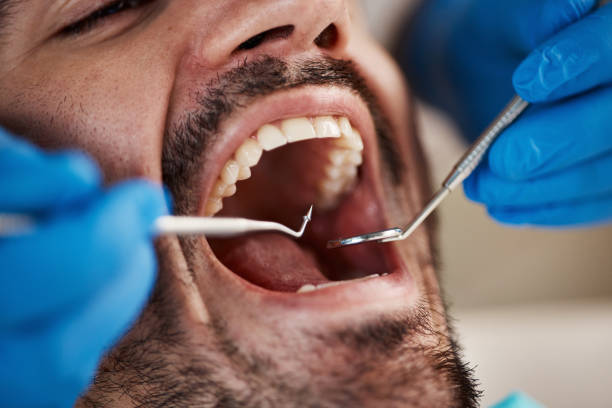 Best Emergency Treatment for Dental Infections or Abscesses in Waynesboro, TN